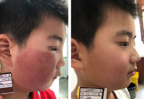 长春哪个医院看皮肤过敏好