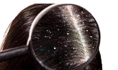 Ϊʲôͷм¶à¡¢Í·Æ¤Ñ÷¡¢Ô½Ï´ÎÊÌâÔ½ÑÏÖØ