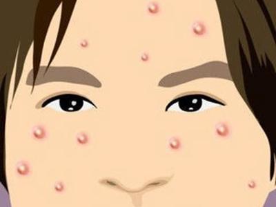 长春肤康医院青春痘治的好吗