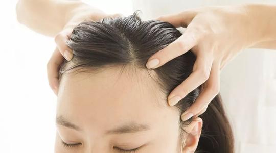 脂溢性脱发冬季如何护理