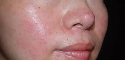 �������沿Ƥ����������Щ