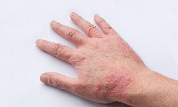 ������Ƥ�׵Ĳ��������