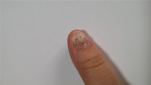 ��ָ����ʲôԭ����ɵ�