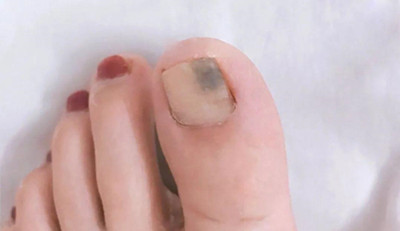 ָ�ײݿ����λ�ָ����