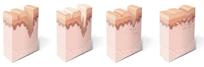 长春凹陷疤痕如何治疗