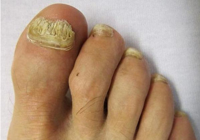 ������ָ��ȥҽԺ���ĸ���