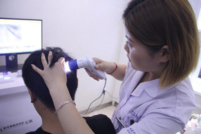 长春做脱发检查需要多少钱