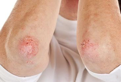 �ļ�ţƤѢ����Ҫ��ô����Ƥ��