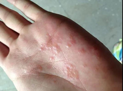 ʪ���������������Щ֢״