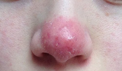 �������ʲôԭ�������