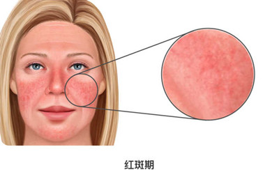 õ�����ʲô����