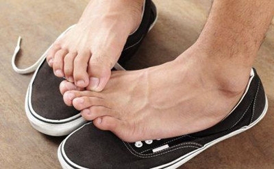 足癣的症状和治疗方法