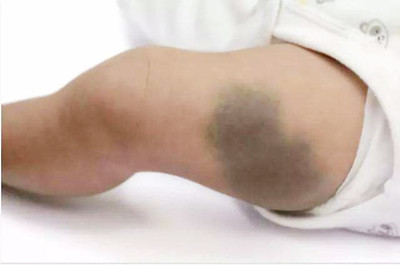 ���Ȱ�̥���ܳ���ȥ����