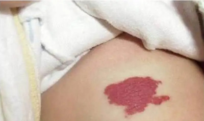 �˽�̥�ǵĳ�����4�����ͣ���ʱ���ƺ���Ҫ��