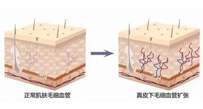 ������Ƥ����Ƥ��������һ������